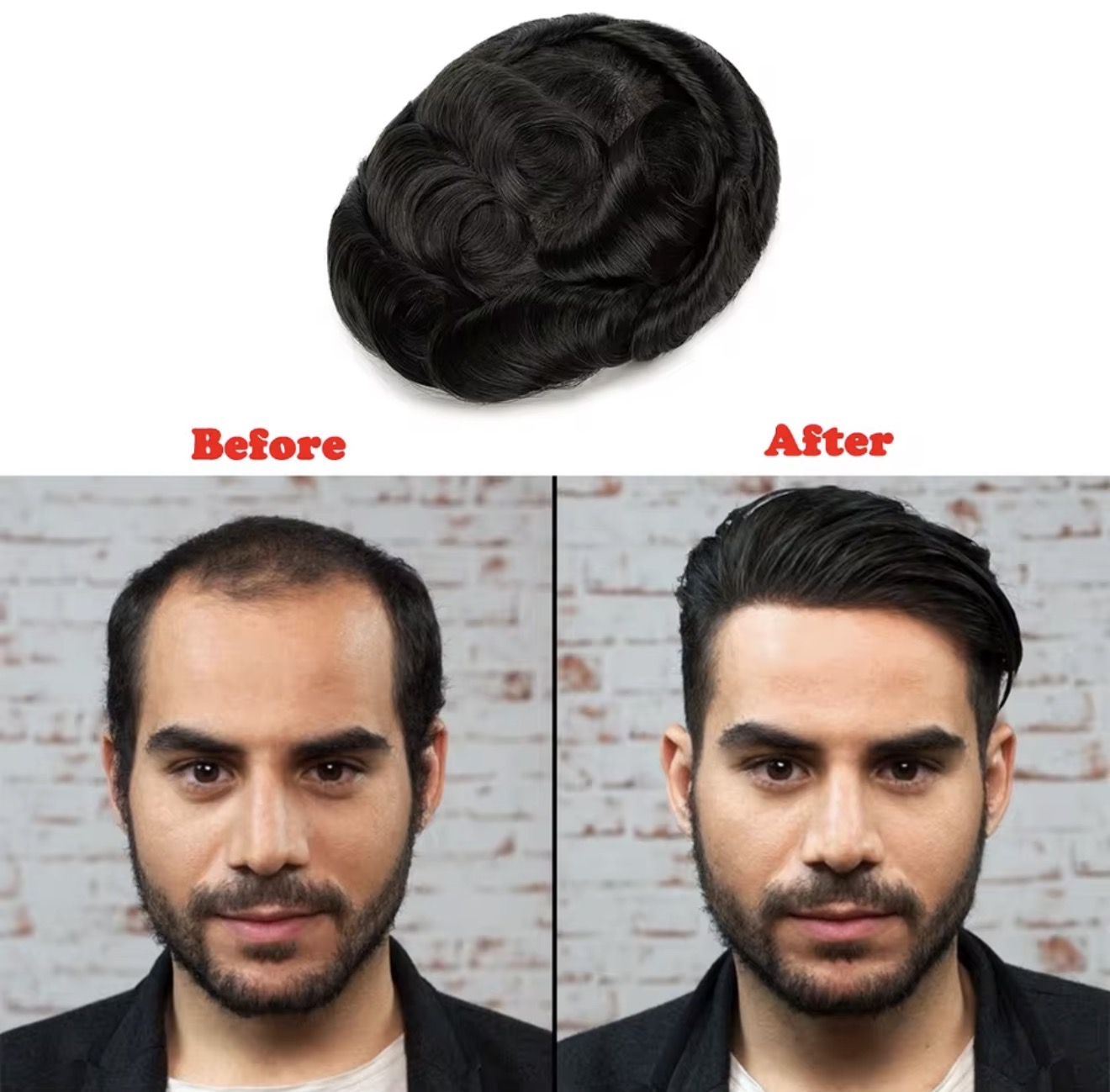 PrimeX Hair System result