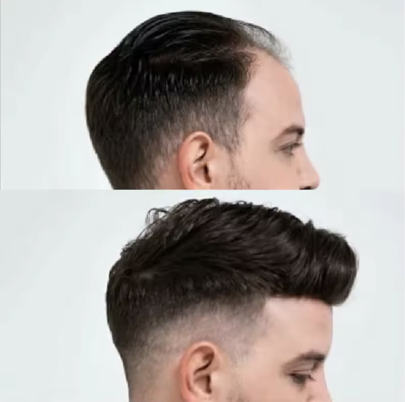 PrimeX Hair System result