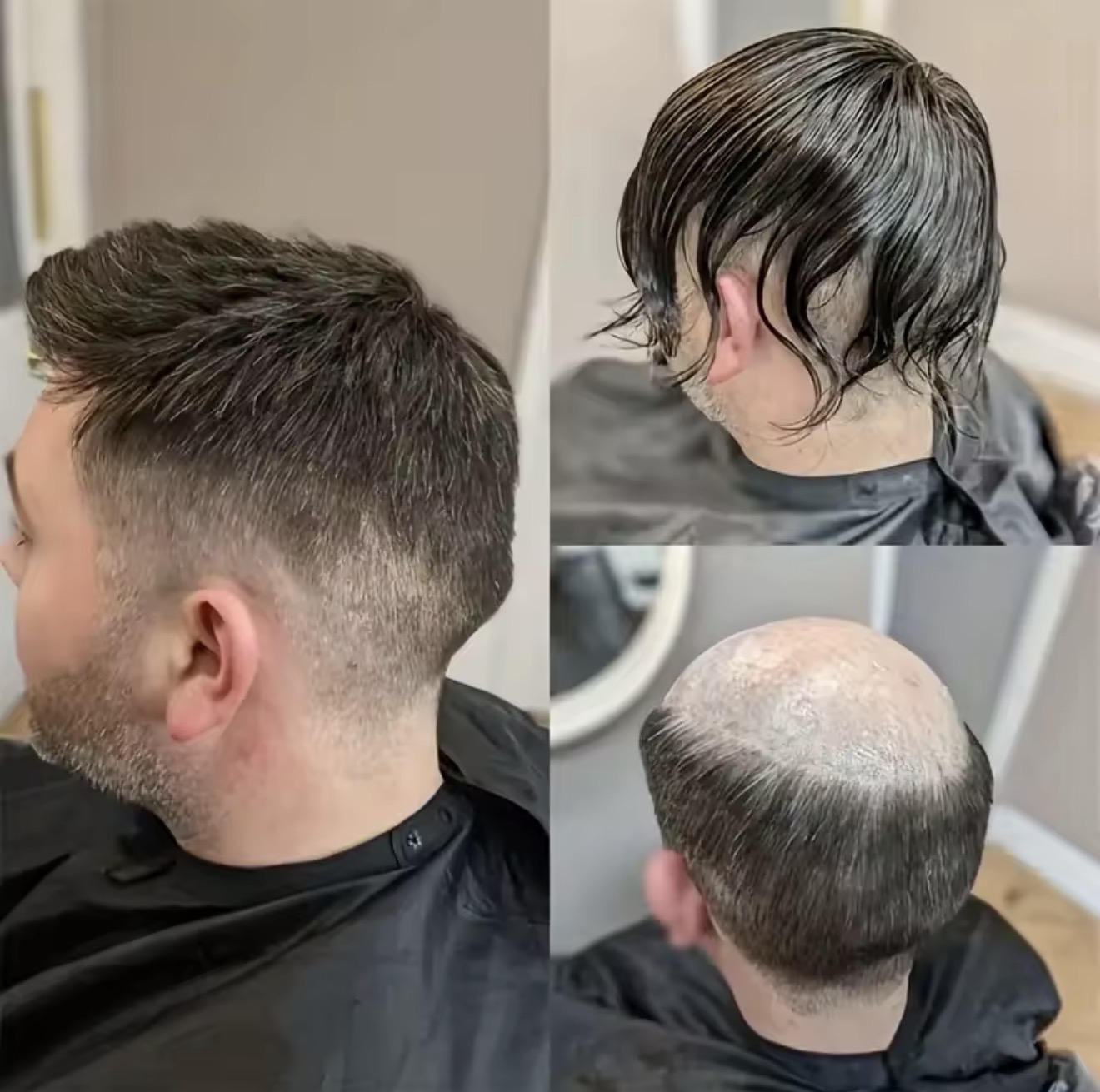 PrimeX Hair System result