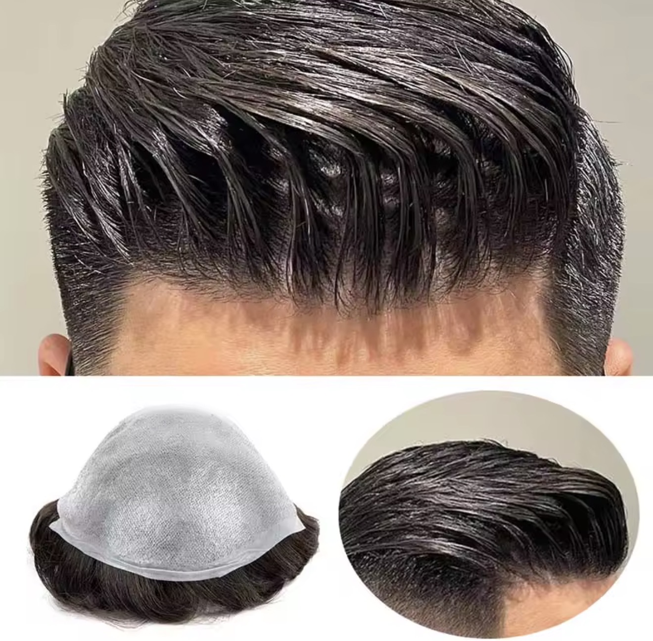 PrimeX Hair System result